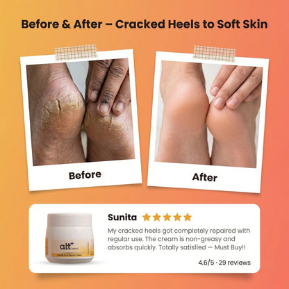 Hand and Foot Repair Cream